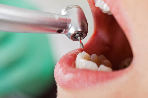 Best Emergency Dental Care for Broken or Chipped Teeth in Whitewright, TX